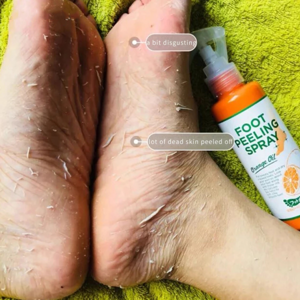 ⁦سبراي تقشير القدم من فوت, ميدي، 110 مل⁩ - الصورة ⁦7⁩