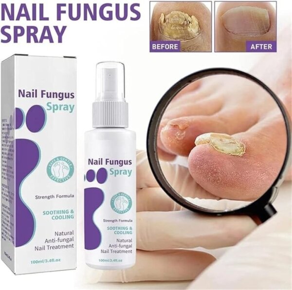 ⁦رذاذ أظافر القدمين medinail sponge spray⁩ - الصورة ⁦2⁩