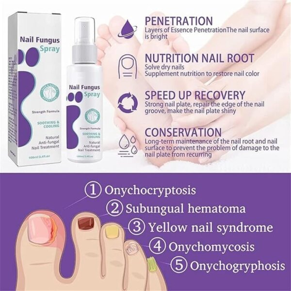 ⁦رذاذ أظافر القدمين medinail sponge spray⁩ - الصورة ⁦7⁩