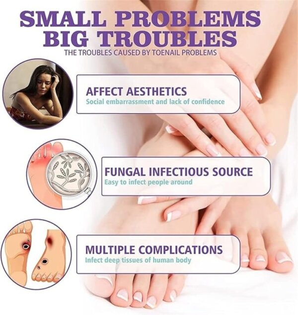 ⁦رذاذ أظافر القدمين medinail sponge spray⁩ - الصورة ⁦8⁩